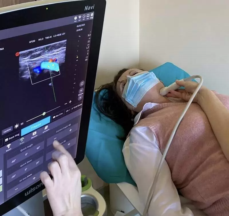 dopler krvnih sudova vrata